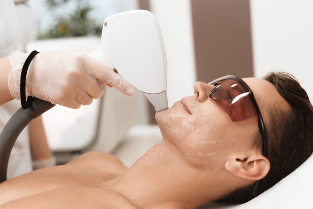 Men's Laser Hair Removal