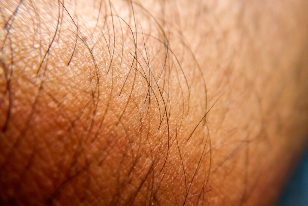 Men's Laser Hair Removal Skin